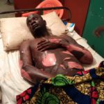 Edo Gas Explosion Victim