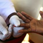 Scientists Achieve Functional Cure for HIV in Monkey Model
