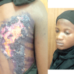 Stepsister tortures teenage girl with hot iron blade