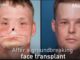 56 hour groundbreaking face transplant surgery gives man a new face