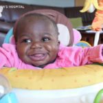 Girl born with 4 legs 2 spines seperated