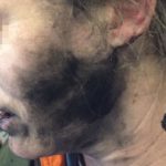 Woman’s headphone batteries explode during flight to Australia