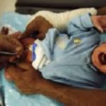 circumsived baby