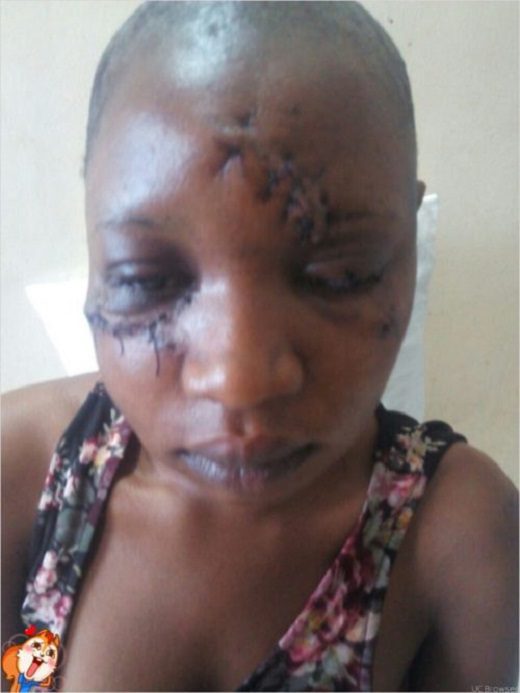 ABUSED WOMEN