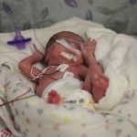 Premature Babies Often Catch Up to Peers in School study