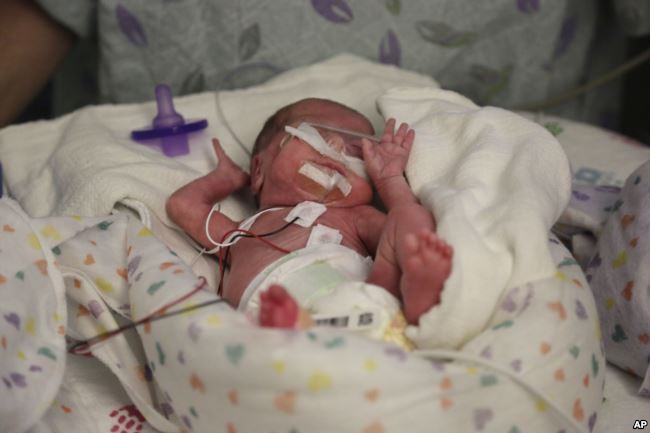 Premature Babies Often Catch Up to Peers in School study