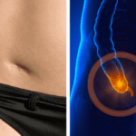 Appendix removal associated with development of Parkinsons disease  Health Research
