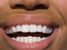 8 habits that can stain teeth
