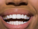 8 habits that can stain teeth