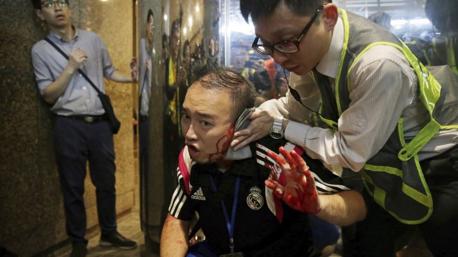Hong Kong protests: Knife attacker bites man's ear after stabbing four
