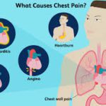 What causes chest pain