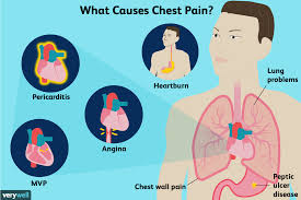 What causes chest pain