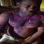 Woman Pours Boiling Water On Sleeping Husband In Bayelsa