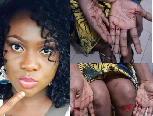 How My Gateman Conspired With Criminals To Attack My Family – Woman Narrates 1