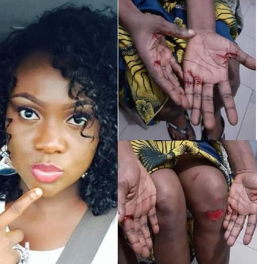 How My Gateman Conspired With Criminals To Attack My Family – Woman Narrates 1