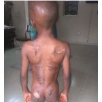 SAD- Woman Burns 8-Year-Old Boy With Iron For Eating Her N50 Groundnut