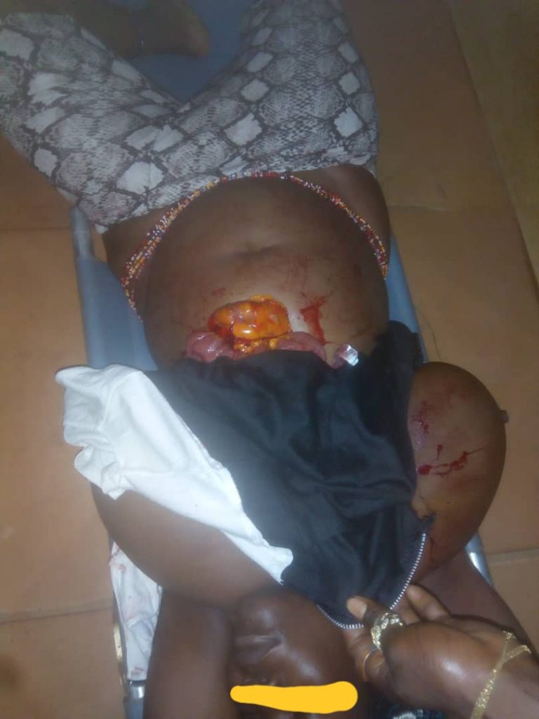 Anambra Police arrest man after he allegedly stabbed and attempted cutting a lady’s breast for rituals 1