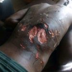 14 year old Anas in critical condition after suspected soldiers in Plateau state brutally tortured him claiming to Teach him a lesson