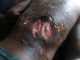 14-year old Anas in critical condition after suspected soldiers in Plateau state brutally tortured him claiming to 'Teach him a lesson'