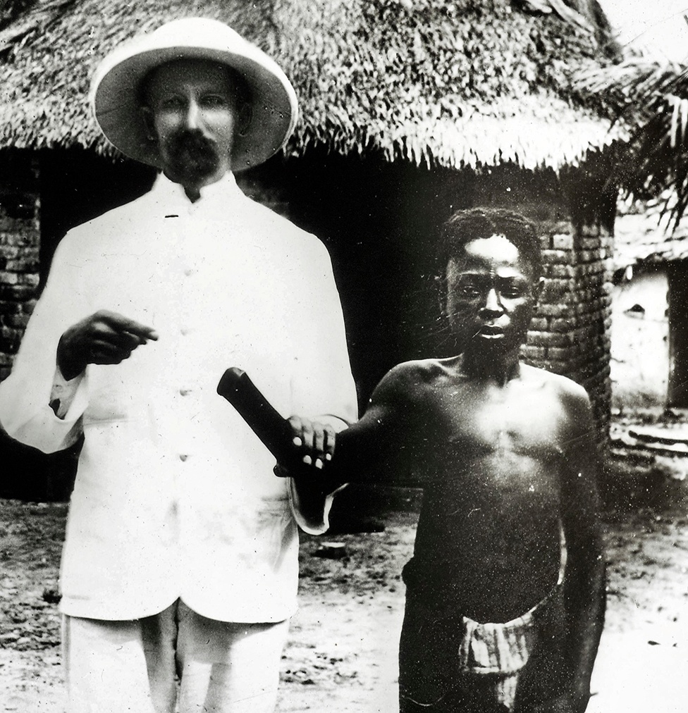 Leopold 2nd of Belgium showing off amputated African child