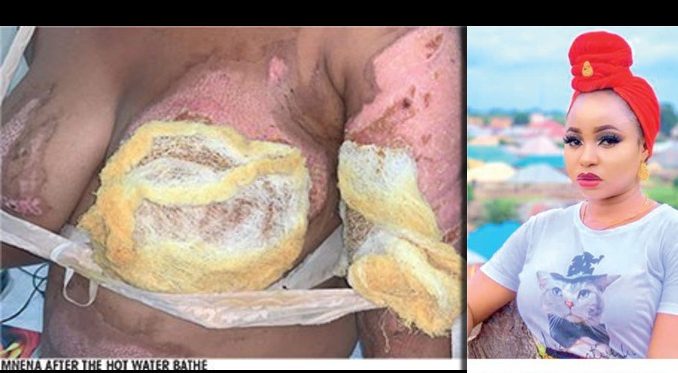 Married Woman ‘Bathes’ Husband's Sidechick With Hot Water, Destroys Her Breasts To Teach Her A Lesson - Before and After