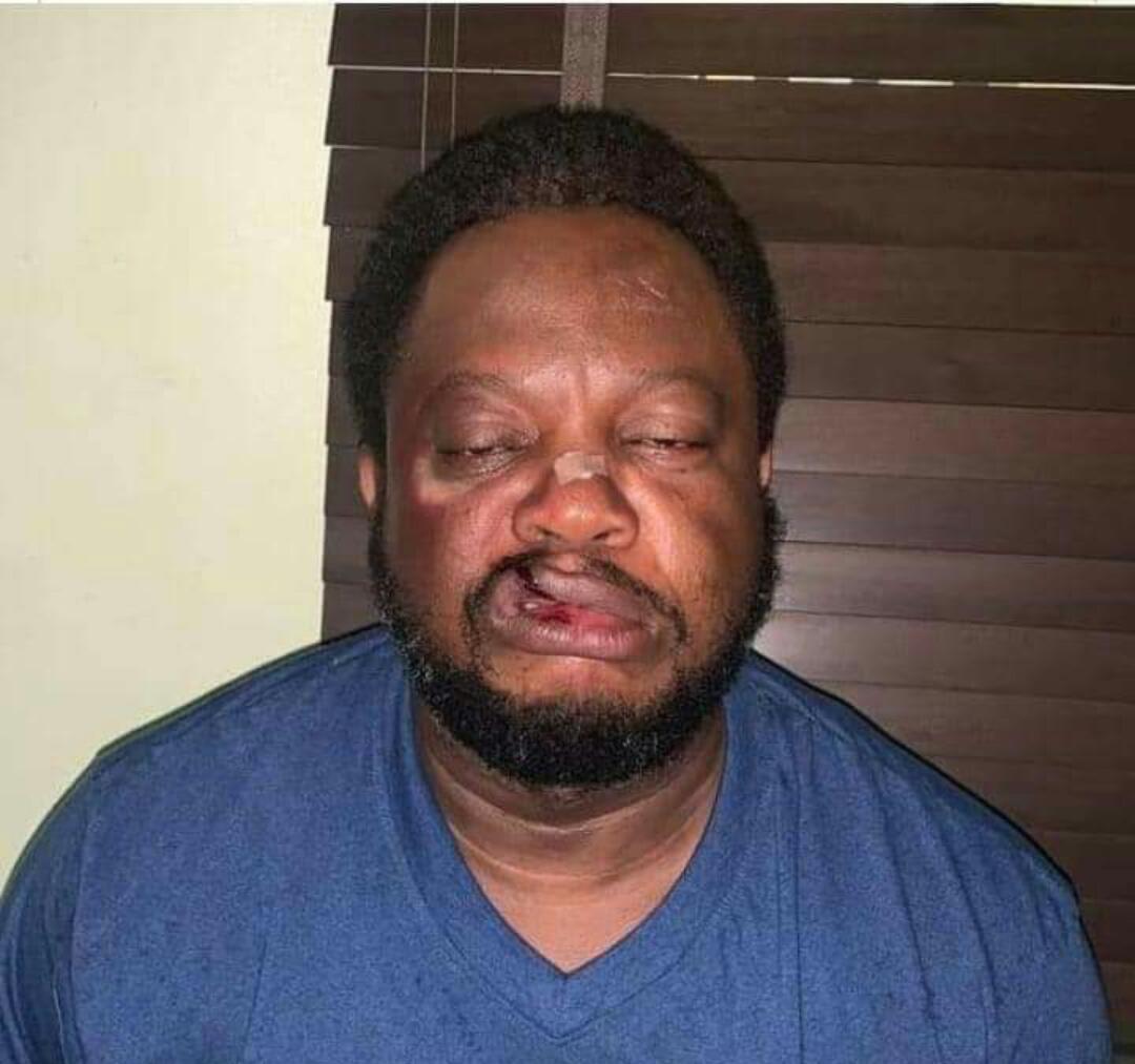 Fictitious story of how Nollywood actor escaped death at the hands of ritual killers in Port Harcourt