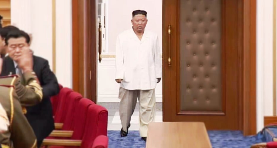 North Korean Leader Kim Jong Un looking emaciated