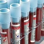 17917269 hiv jpegbba9b49e5598a21931d37ee1963fad71