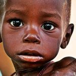 Bauchi registers over 100 new cases of malnutrition every week   Nutritionist