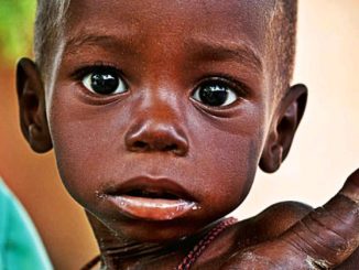 Bauchi registers over 100 new cases of malnutrition every week - Nutritionist