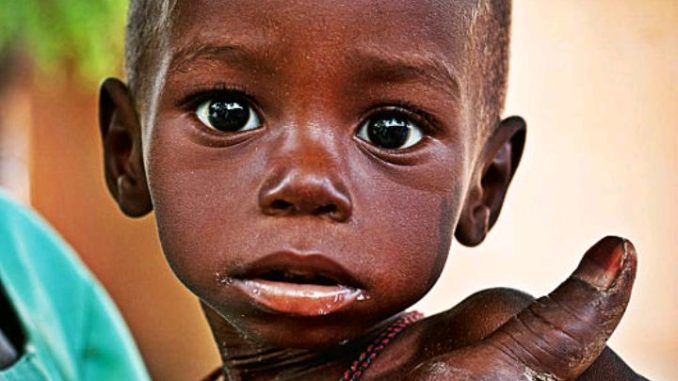 Bauchi registers over 100 new cases of malnutrition every week - Nutritionist