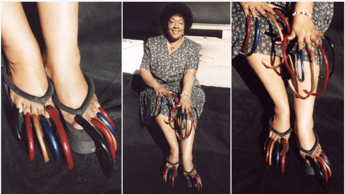 World’s longest toenails Guinness record holder, Louise Hollis dies aged 86