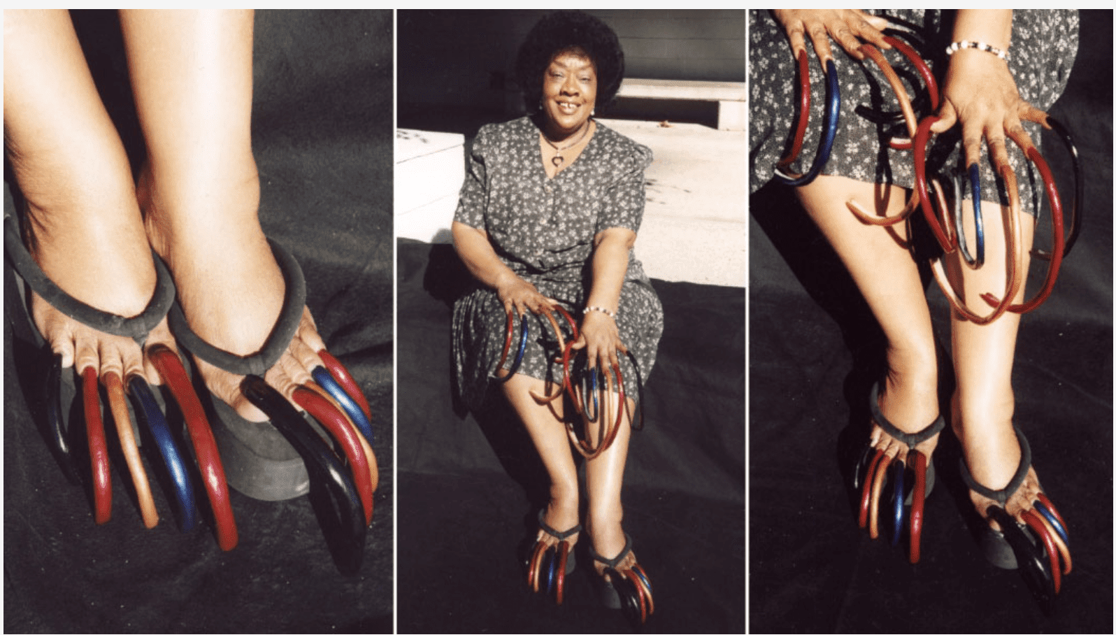 World’s longest toenails Guinness record holder, Louise Hollis dies aged 86